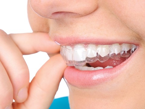 Cosmetic Dentistry Vs Orthodontics