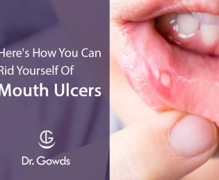 Here's How You Can Treat Ulcers At Home