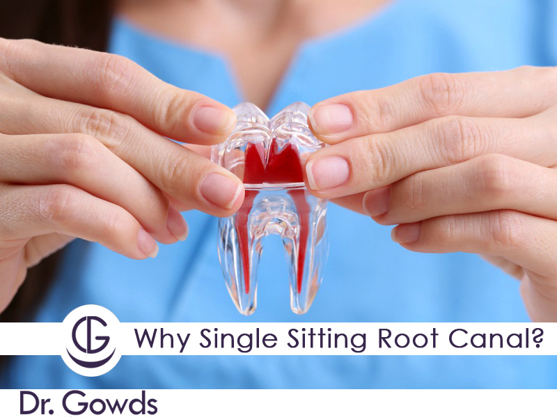 Why Single Sitting Root Canal?