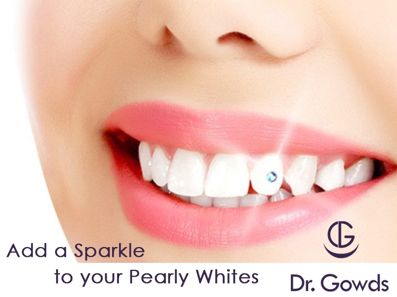 Want to add a Sparkle to your Pearly whites – try Tooth Jewelry