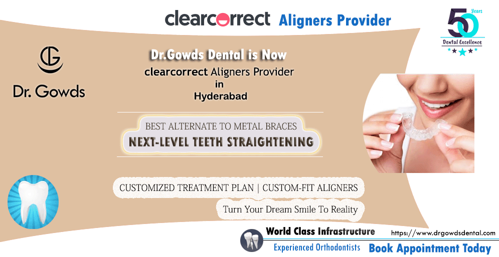 Clearcorrect Dental Aligners Provider in Hyderabad
