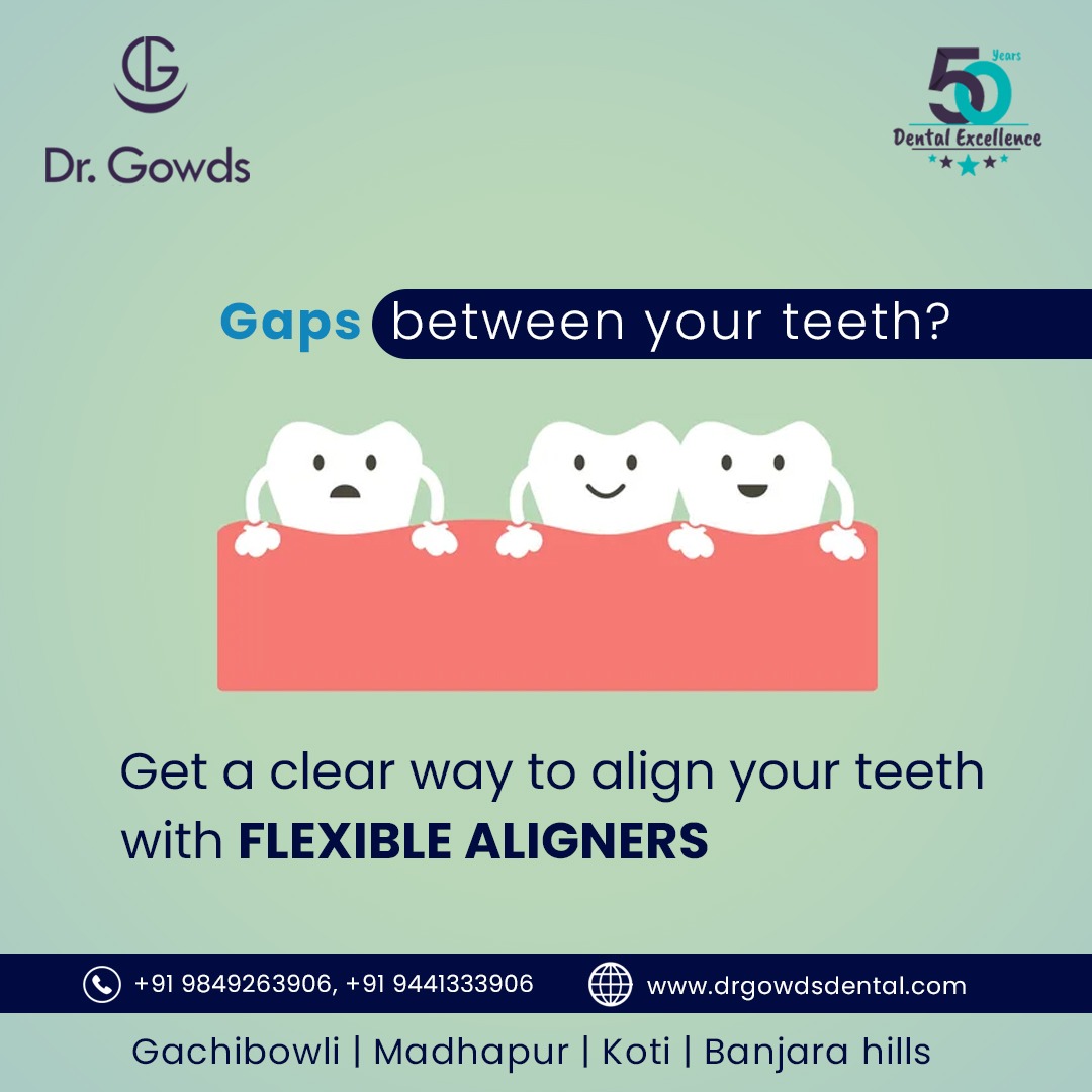Clear Aligners | Dental Aligners | Invisible Aligners | Virtually invisible